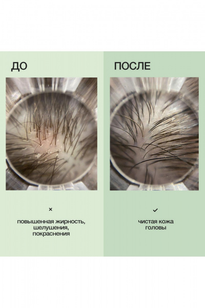 Детокс-шампунь против жирности с экстрактами и церамидом Limba Cosmetics Detox Oily Hair Cleansing Shampoo - фото 4